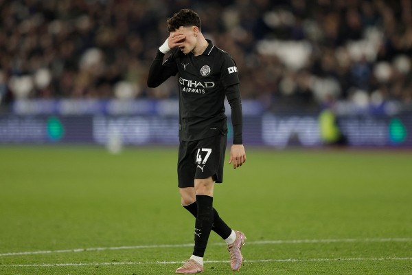 曼城投降嗎？哥迪奧拿：總有希望